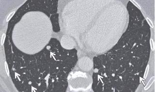 北京科兴疫苗怎么了 北京科兴疫苗怎么了